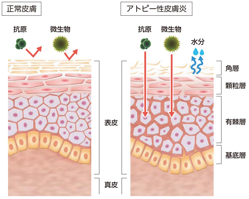 皮膚バリア機能の模式図