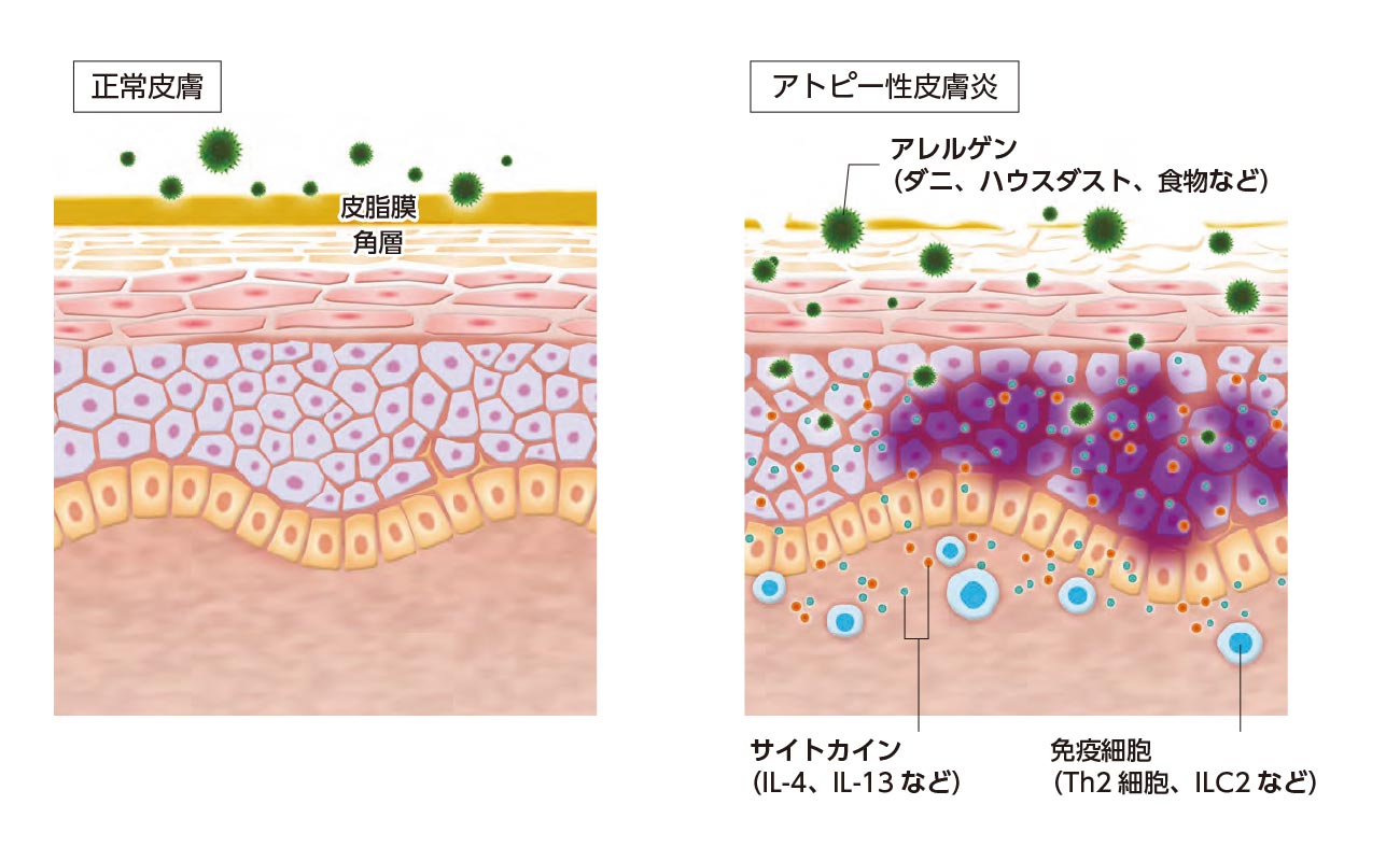 免疫系の模式図