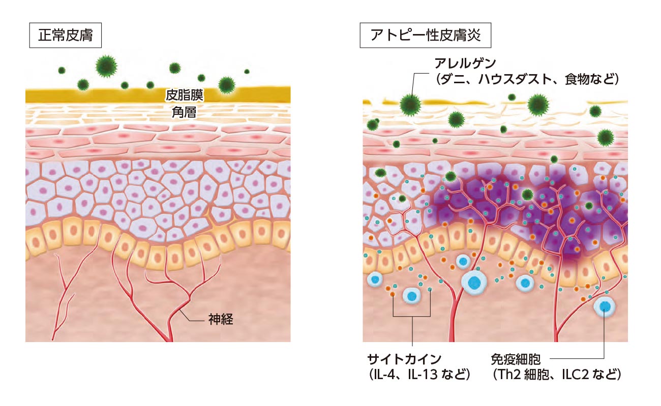 かゆみの神経メカニズム